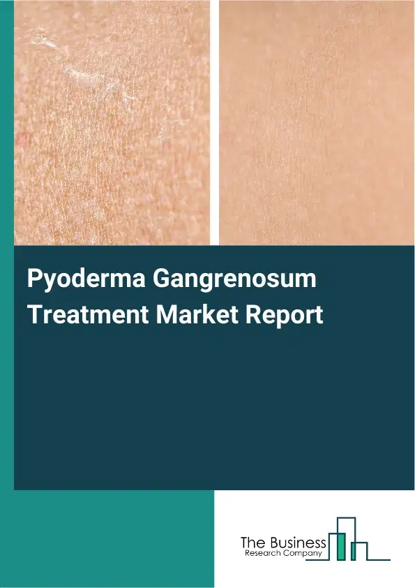 Global Pyoderma Gangrenosum Treatment Market Report 2026