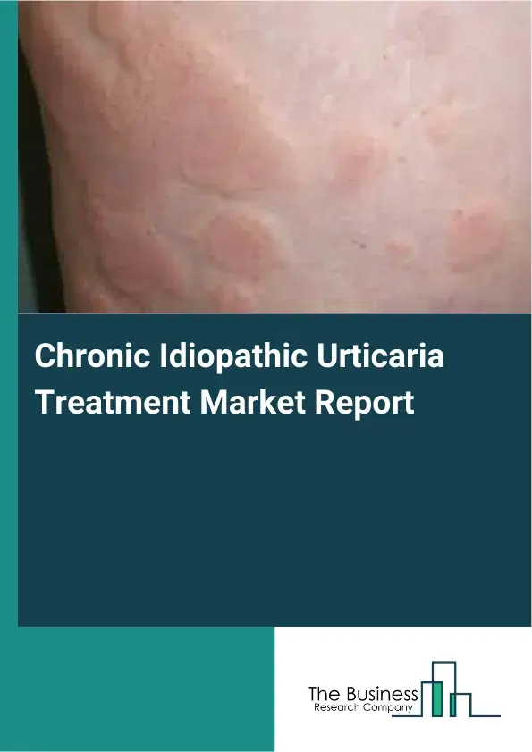 Global Chronic Idiopathic Urticaria Treatment Market Report 2026 Global Chronic Idiopathic Urticaria Treatment Market Report 2026