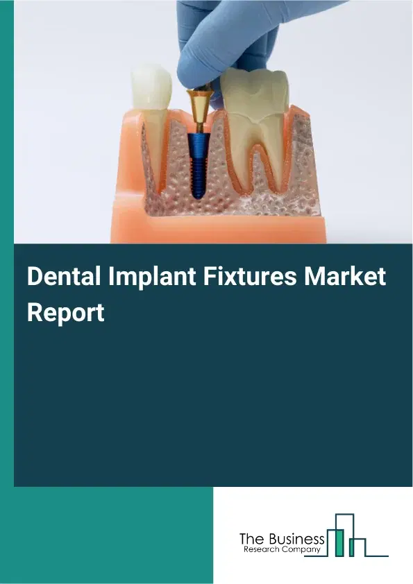 Global Dental Implant Fixtures Market Report 2026 Global Dental Implant Fixtures Market Report 2026