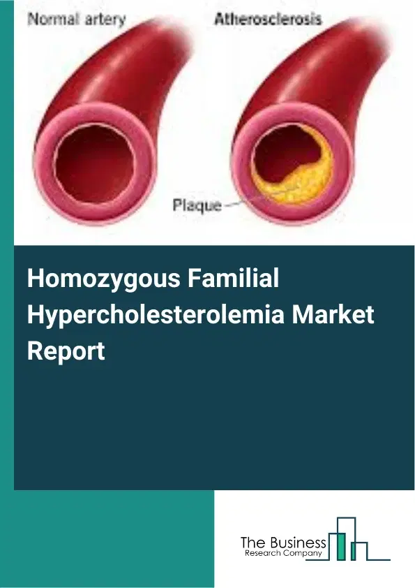 Global Homozygous Familial Hypercholesterolemia Market Report 2026 Global Homozygous Familial Hypercholesterolemia Market Report 2026