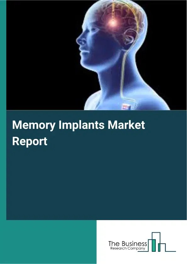 Global Memory Implants Market Report 2026 Global Memory Implants Market Report 2026
