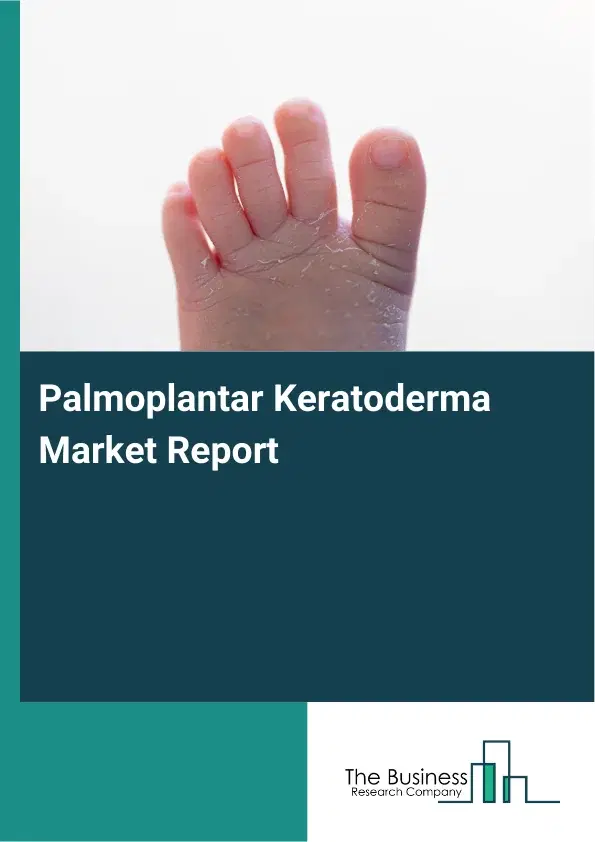 Global Palmoplantar Keratoderma Market Report 2026 Global Palmoplantar Keratoderma Market Report 2026